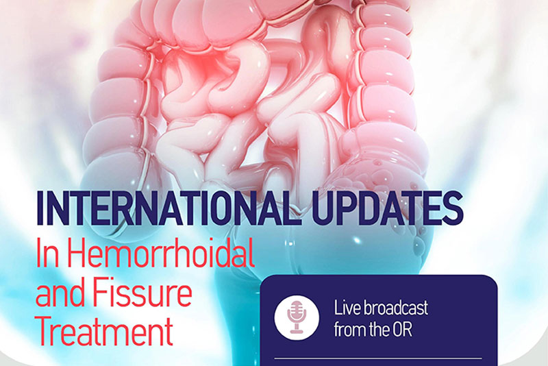 International Updates in Hemorrhoidal and Fissure Treatment